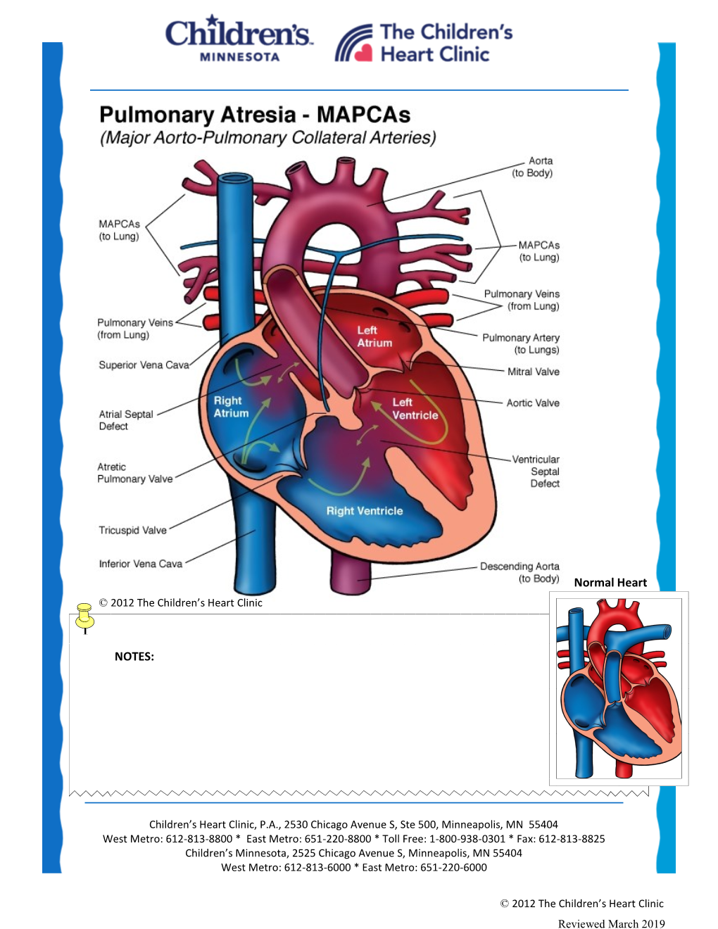 Pulmonary-Atresia-Mapcas-Pavsdmapcas.Pdf