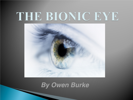By Owen Burke • a Prosthetic Eye Or Bionic Eye, Is a Technological Device That Aims to Restore Basic Vision to People Suffering Degenerative Blinding Diseases