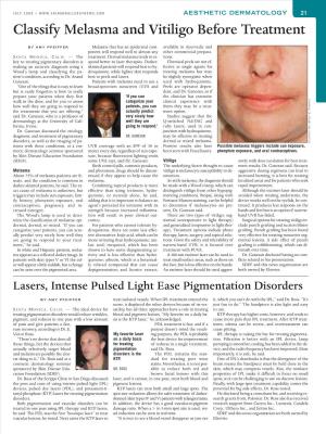 Lasers, Intense Pulsed Light Ease Pigmentation Disorders