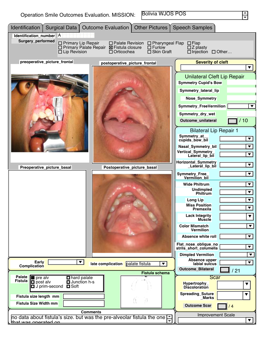 Operation Smile Outcomes Evaluation. MISSION: Bolivia WJOS POS