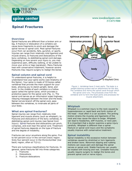 Spinal Fractures.Pdf