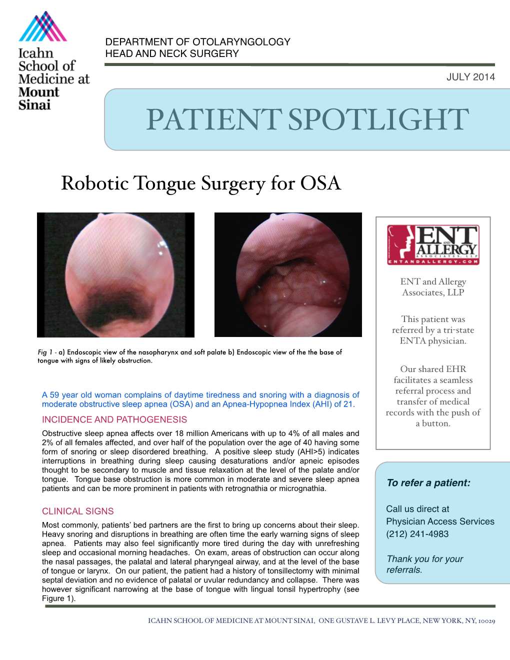 Patient Spotlight: Robotic Tongue Surgery For