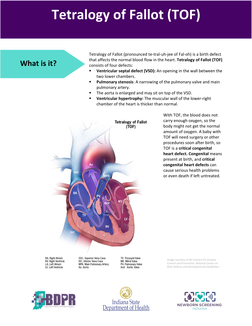 Tetralogy of Fallot (TOF)