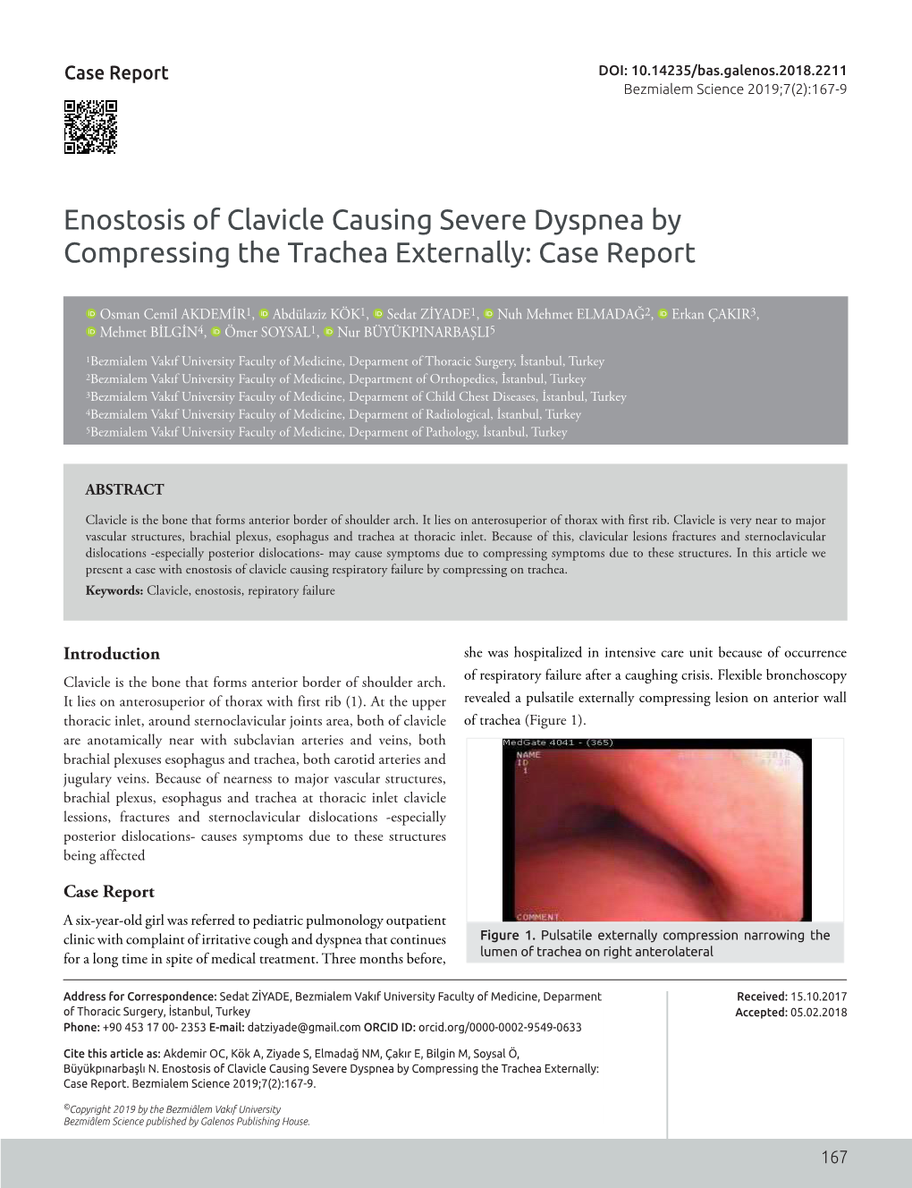 Enostosis of Clavicle Causing Severe Dyspnea by Compressing the Trachea Externally: Case Report