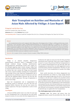 Hair Transplant on Hairline and Mustache of Asian Male Affected by Vitiligo: a Case Report