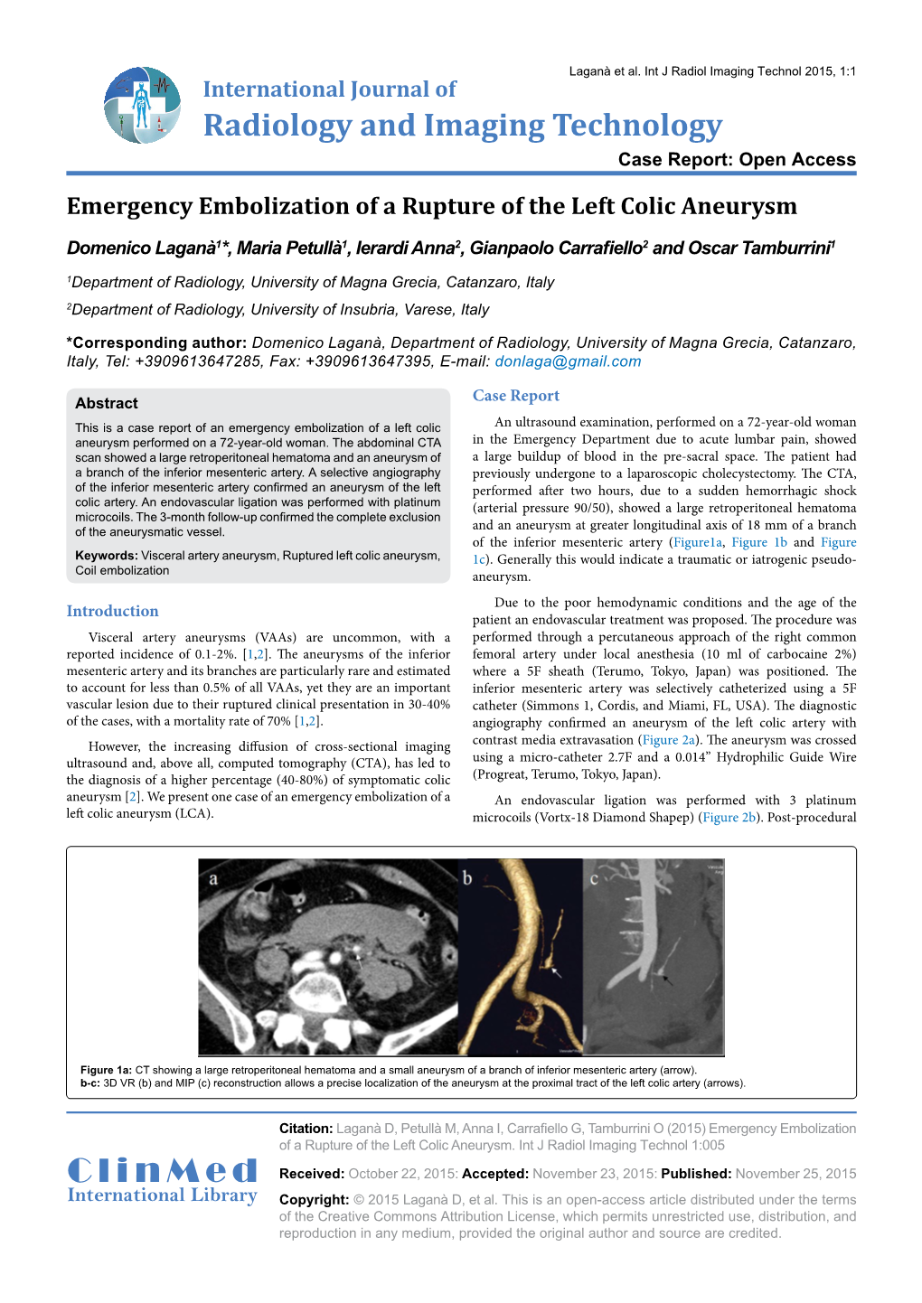 Emergency Embolization of a Rupture of the Left Colic Aneurysm