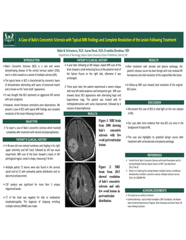 A Case of Balo's Concentric Sclerosis with Typical MRI Findings and Complete Resolution of the Lesion Followi