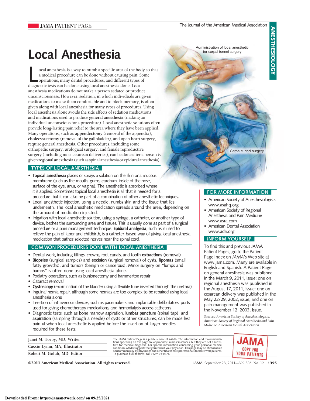 Local Anesthesia for Carpal Tunnel Surgery