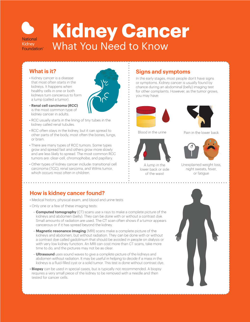 Kidney Cancer What You Need to Know
