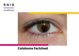 Download Our Coloboma Factsheet In