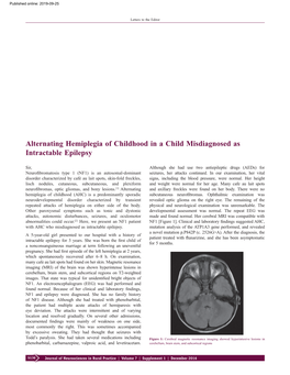 Alternating Hemiplegia of Childhood in a Child Misdiagnosed As Intractable Epilepsy