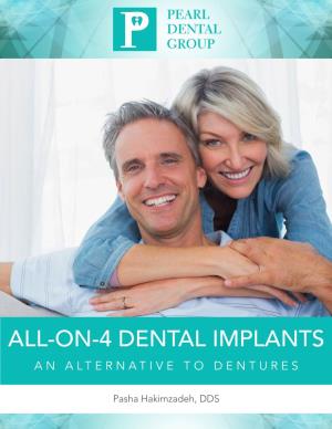 All-On-4 Dental Implants an Alternative to Dentures