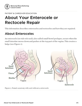 About Your Enterocele Or Rectocele Repair