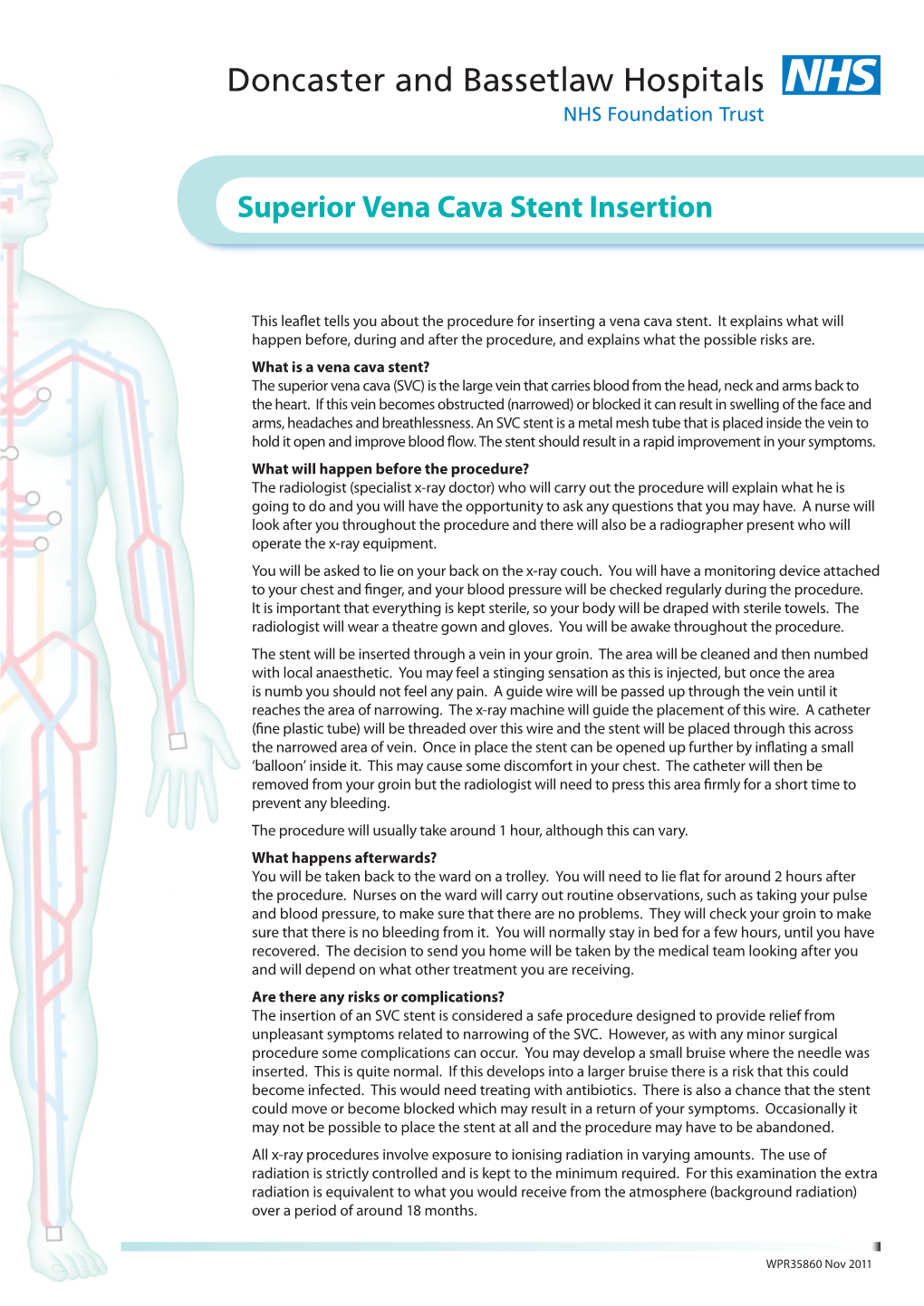 Superior Vena Cava Stent Insertion