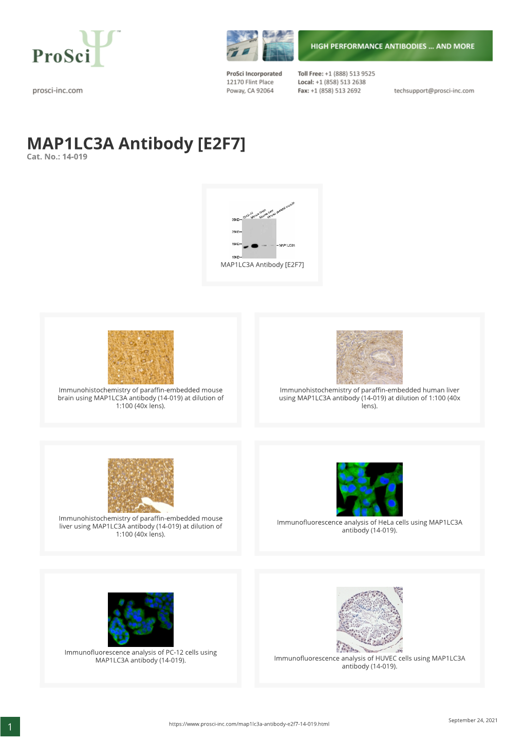 MAP1LC3A Antibody [E2F7] Cat