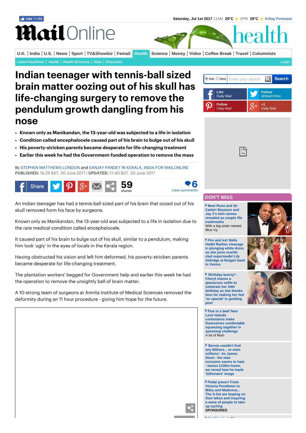 Indian Teenager with Tennis-Ball Sized Brain Matter Oozing out of His Skull