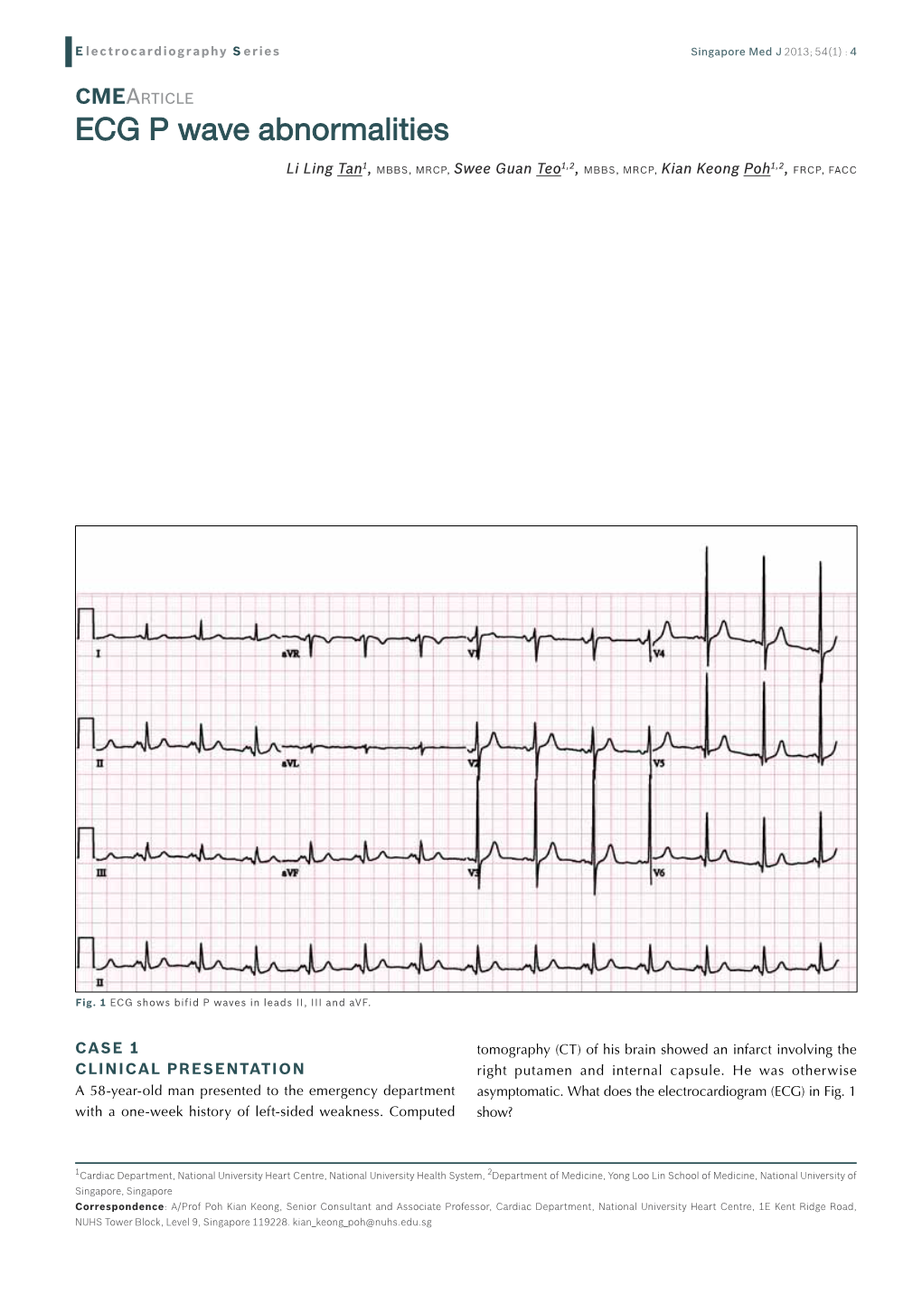 ECG P Wave Abnormalities