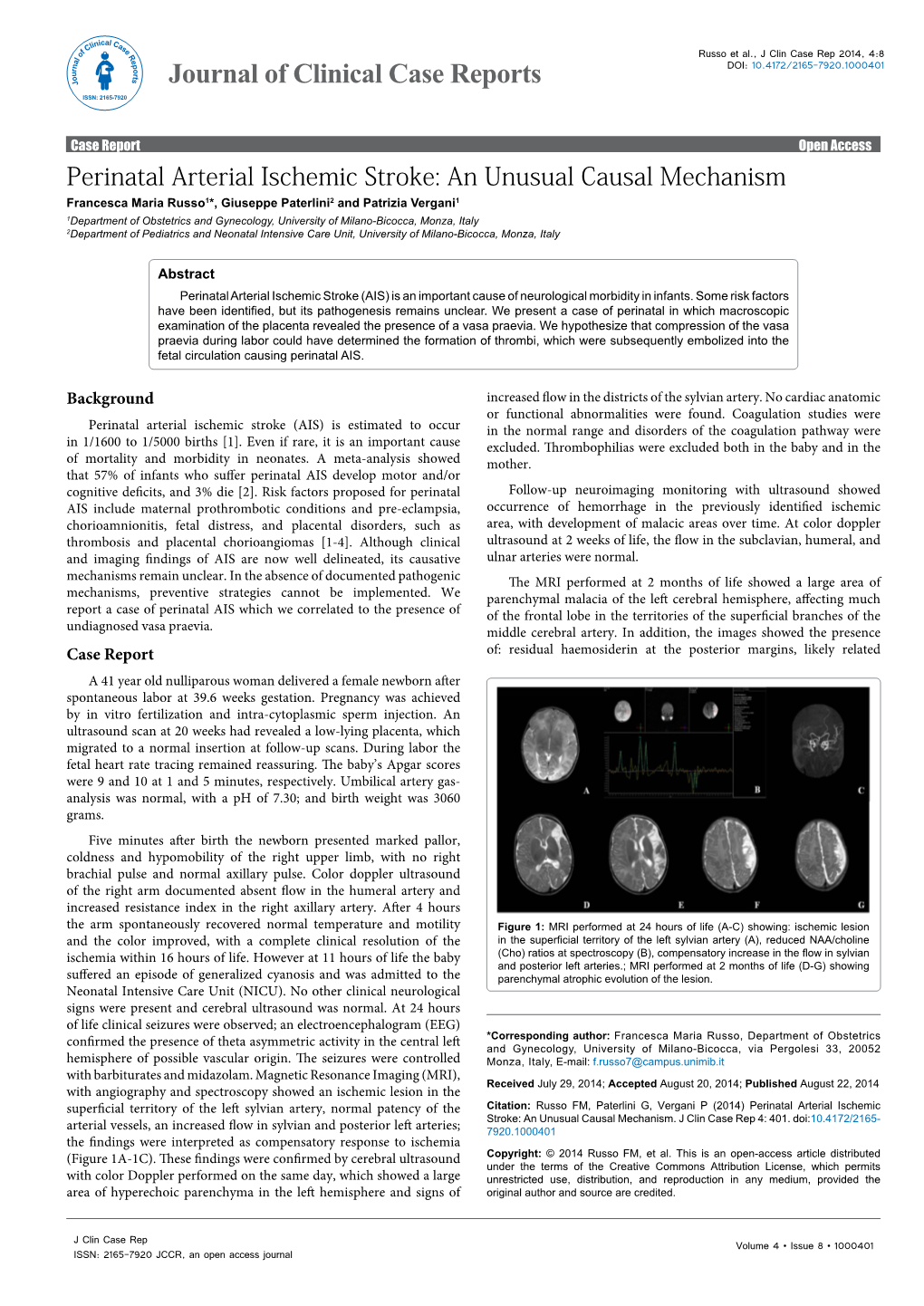 Perinatal Arterial Ischemic Stroke: an Unusual Causal Mechanism