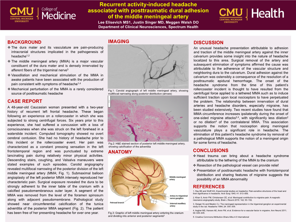 Recurrent Activity-Induced Headache Associated with Posttraumatic Dural