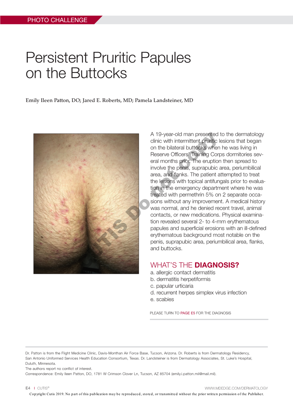 Persistent Pruritic Papules on the Buttocks