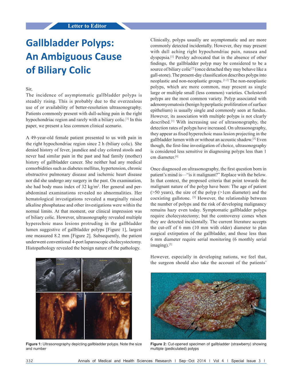 Gallbladder Polyps: an Ambiguous Cause of Biliary Colic