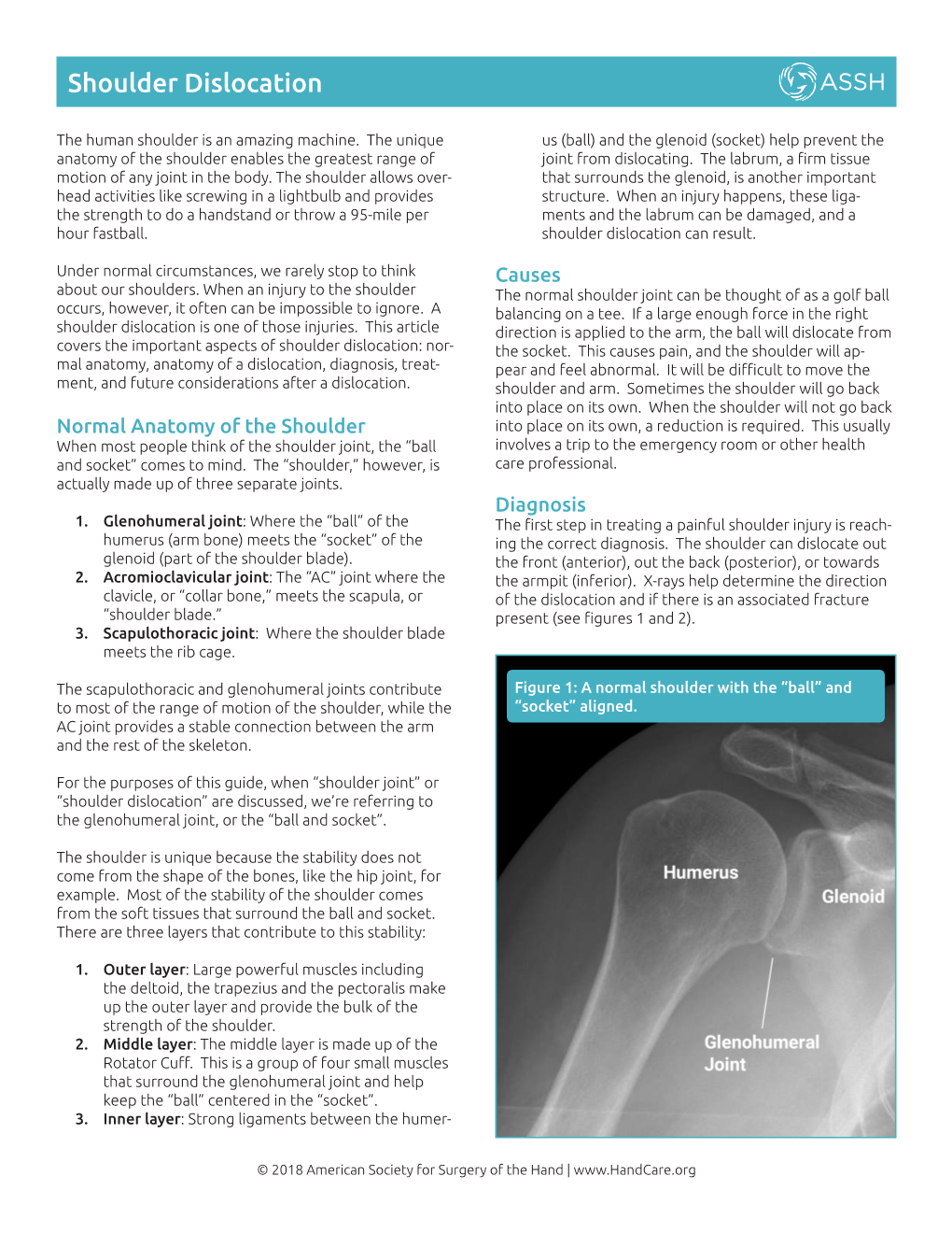 Shoulder Dislocation