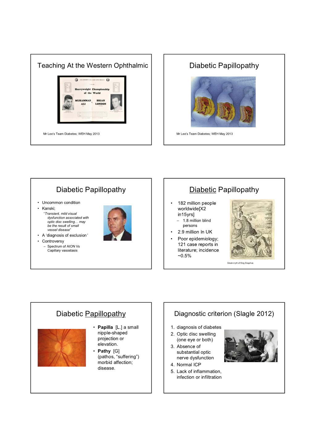 Diabetic Papillopathy Diabetic Papillopathy