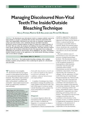 Managing Discoloured Non-Vital Teeth: the Inside/Outside Bleaching Technique