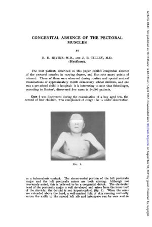 Congenital Absence of the Pectoral Muscles