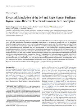 Electrical Stimulation of the Left and Right Human Fusiform Gyrus Causes Different Effects in Conscious Face Perception