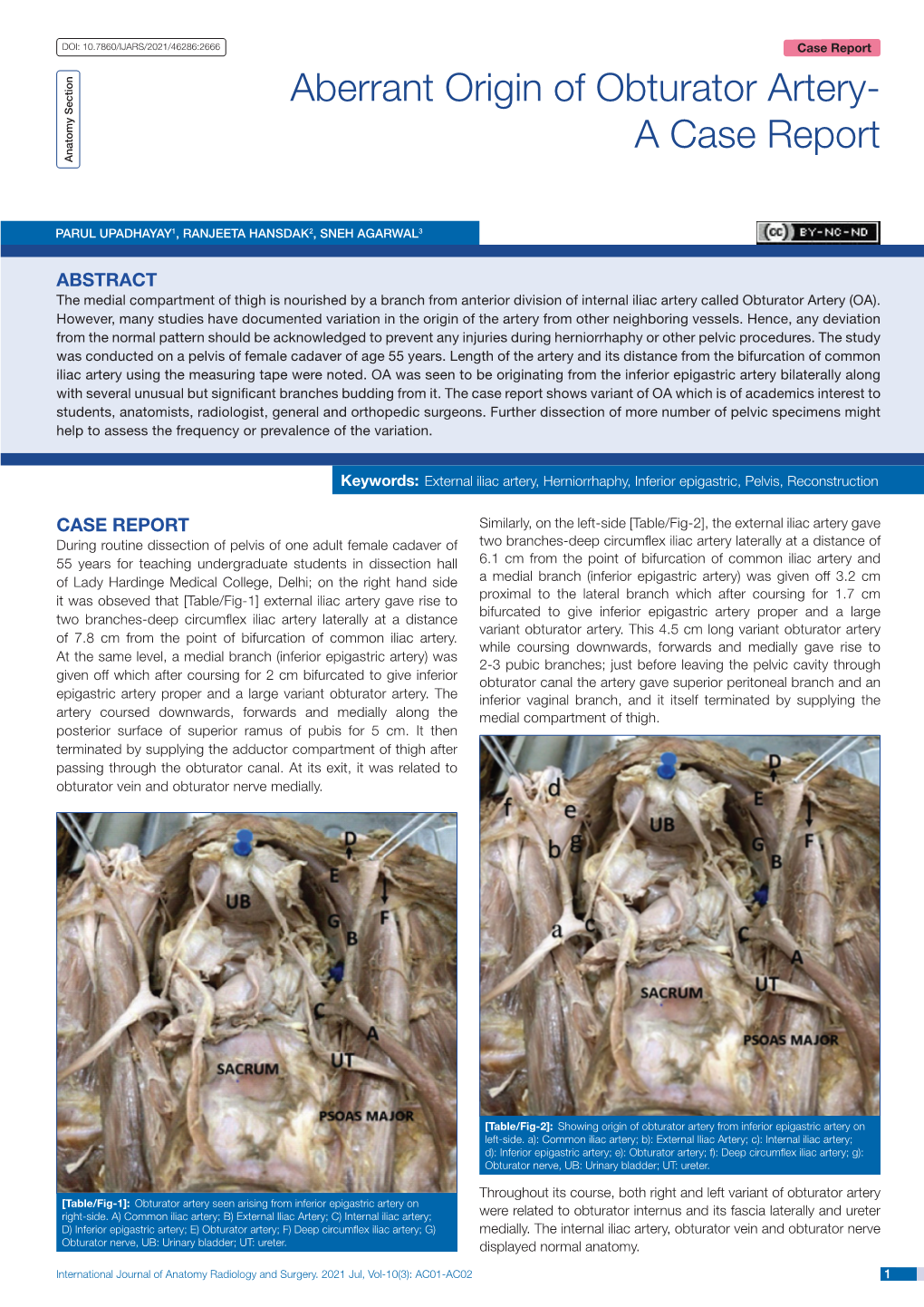 Aberrant Origin of Obturator Artery- a Case Report Anatomy Section