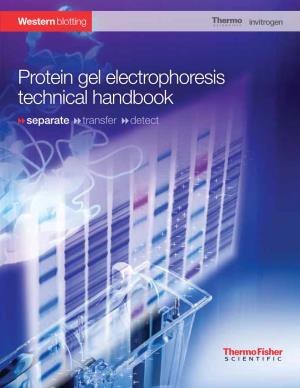 Protein Gel Electrophoresis Technical Handbook Separate Transfer Detect 2