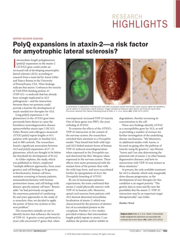 Polyq Expansions in Ataxin-2—A Risk Factor for Amyotrophic Lateral Sclerosis?