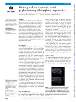 Silicone Granuloma: a Cause of Cervical Lymphadenopathy Following Breast Implantation Amarkumar Dhirajlal Rajgor ‍ ‍ ,1,2 Youssef Mentias,2 Francis Stafford2