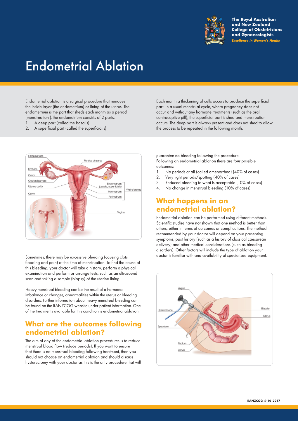 Endometrial Ablation