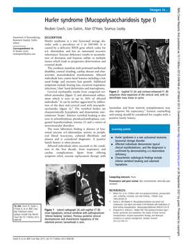 Hurler Syndrome (Mucopolysaccharidosis Type I) Reuben Grech, Leo Galvin, Alan O’Hare, Seamus Looby