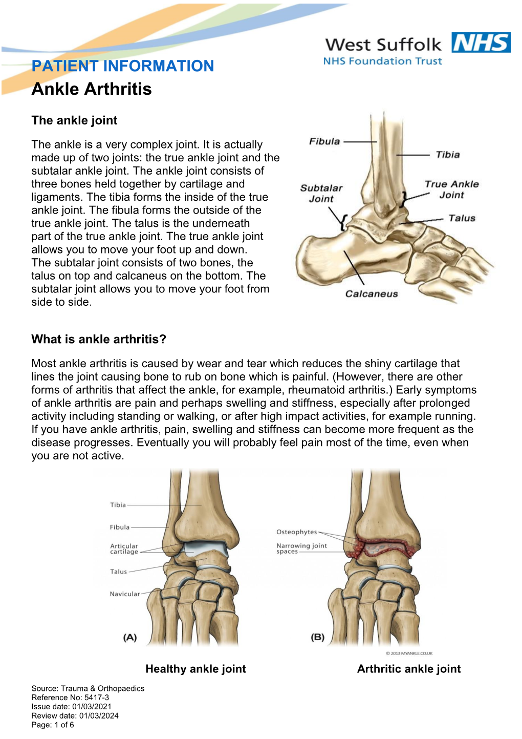 PATIENT INFORMATION Ankle Arthritis