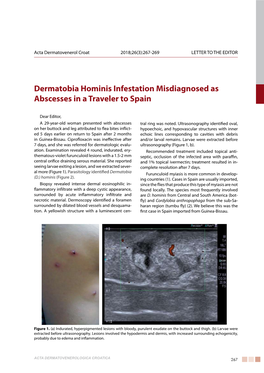 Dermatobia Hominis Infestation Misdiagnosed As Abscesses in a Traveler to Spain
