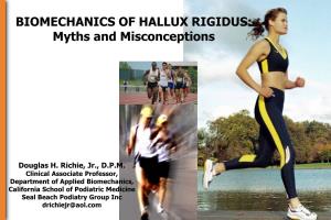 HALLUX RIGIDUS: Myths and Misconceptions