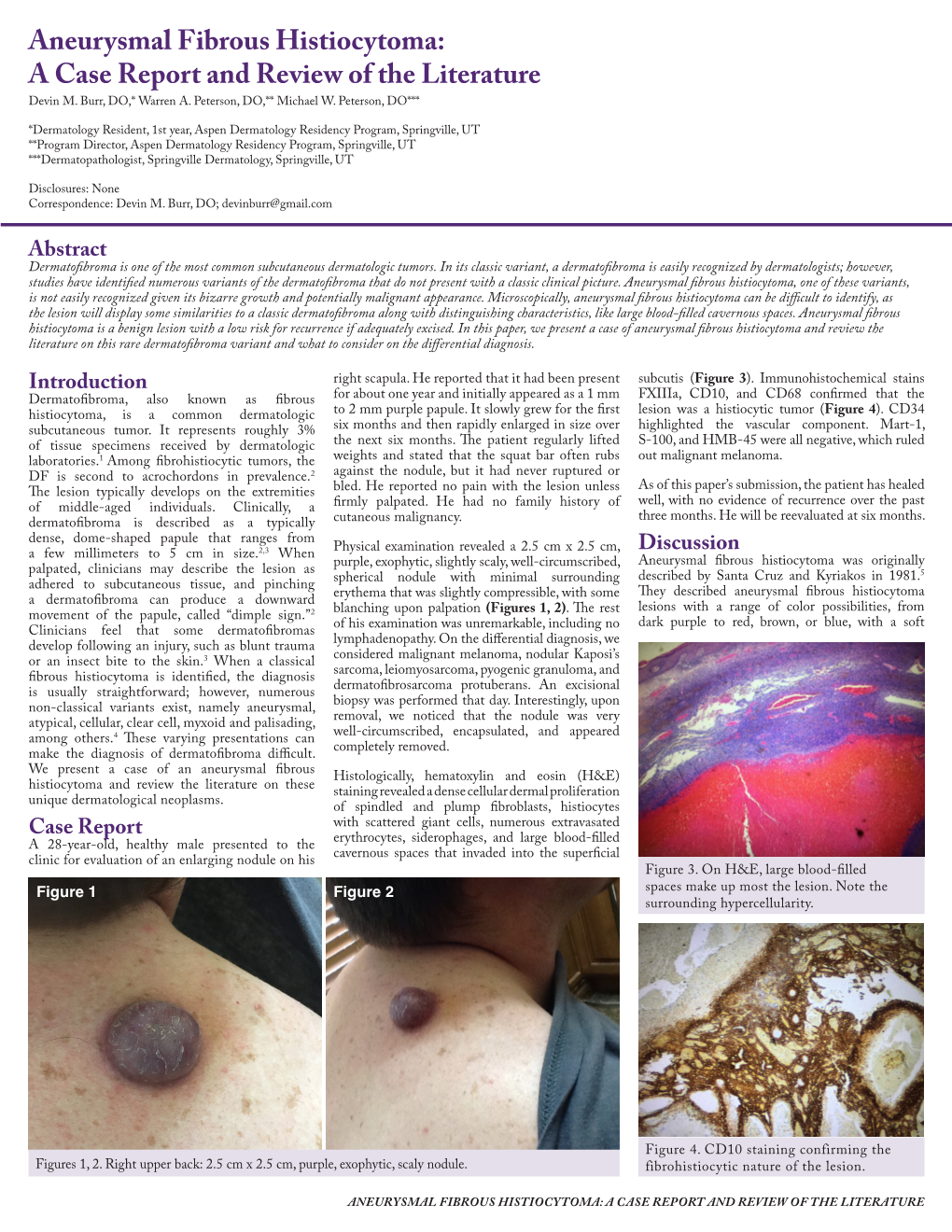 Aneurysmal Fibrous Histiocytoma: a Case Report and Review of the Literature Devin M