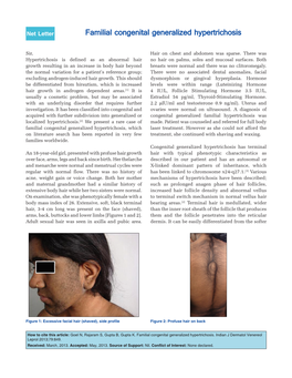 Familial Congenital Generalized Hypertrichosis, Which Laser Treatment