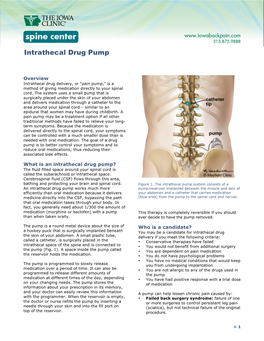 Intrathecal Drug Pump