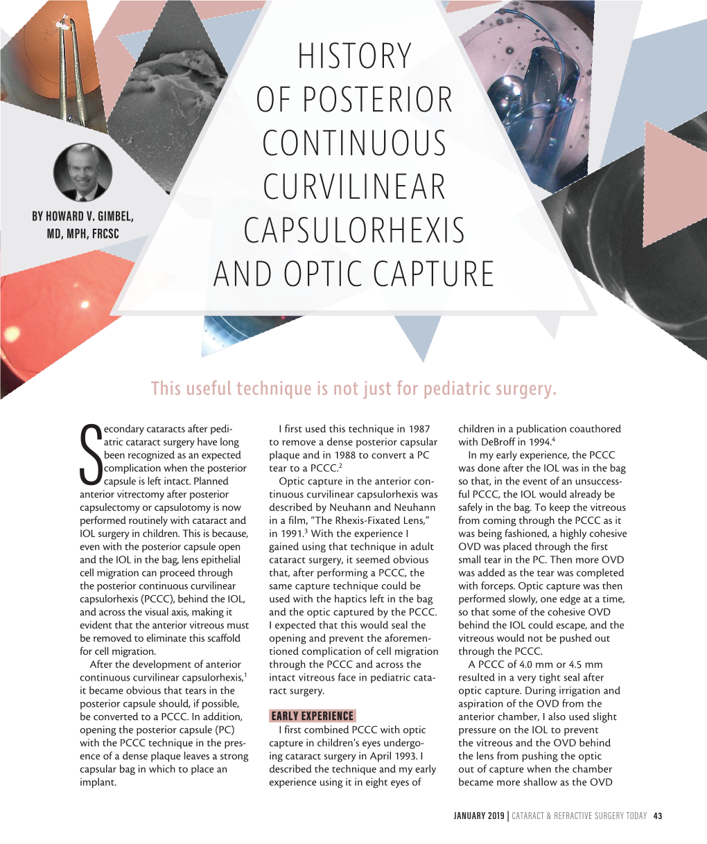 History of Posterior Continuous Curvilinear Capsulorhexis and Optic