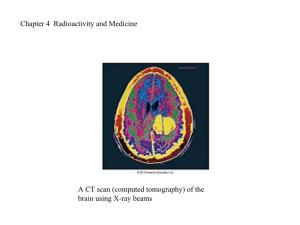 Chapter 4 Radioactivity and Medicine a CT Scan (Computed Tomography)