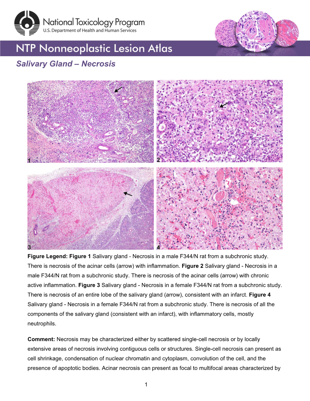 Salivary Gland – Necrosis