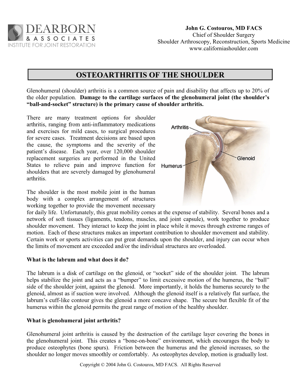 Osteoarthritis of the Shoulder