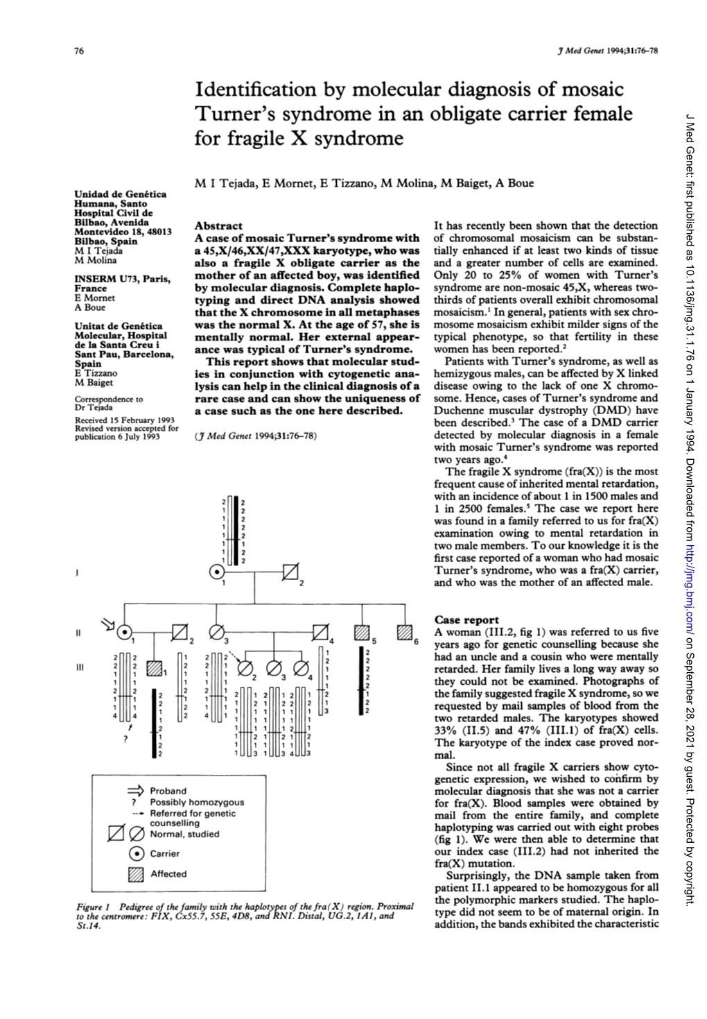 Turner's Syndrome in an Obligate Carrier Female for Fragile X Syndrome