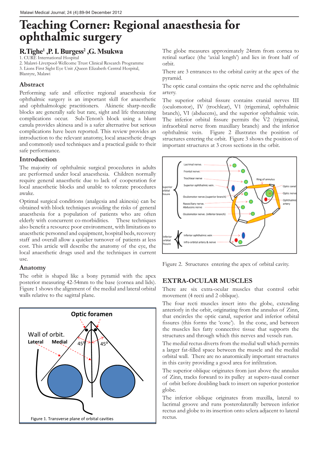 Teaching Corner: Regional Anaesthesia for Ophthalmic Surgery R.Tighe1 ,P