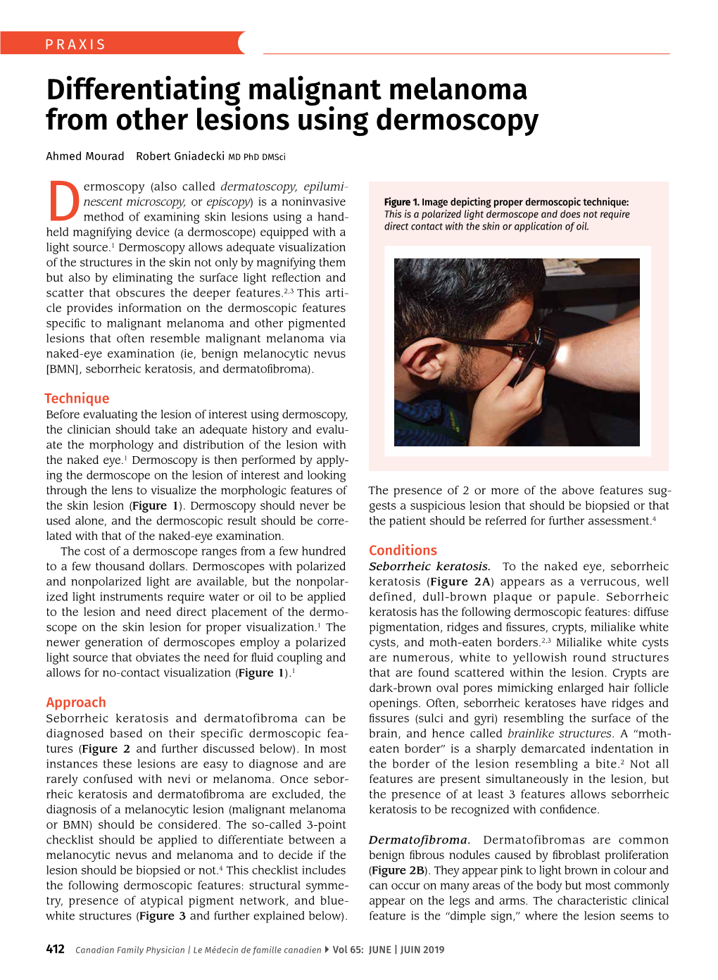 Differentiating Malignant Melanoma from Other Lesions Using Dermoscopy