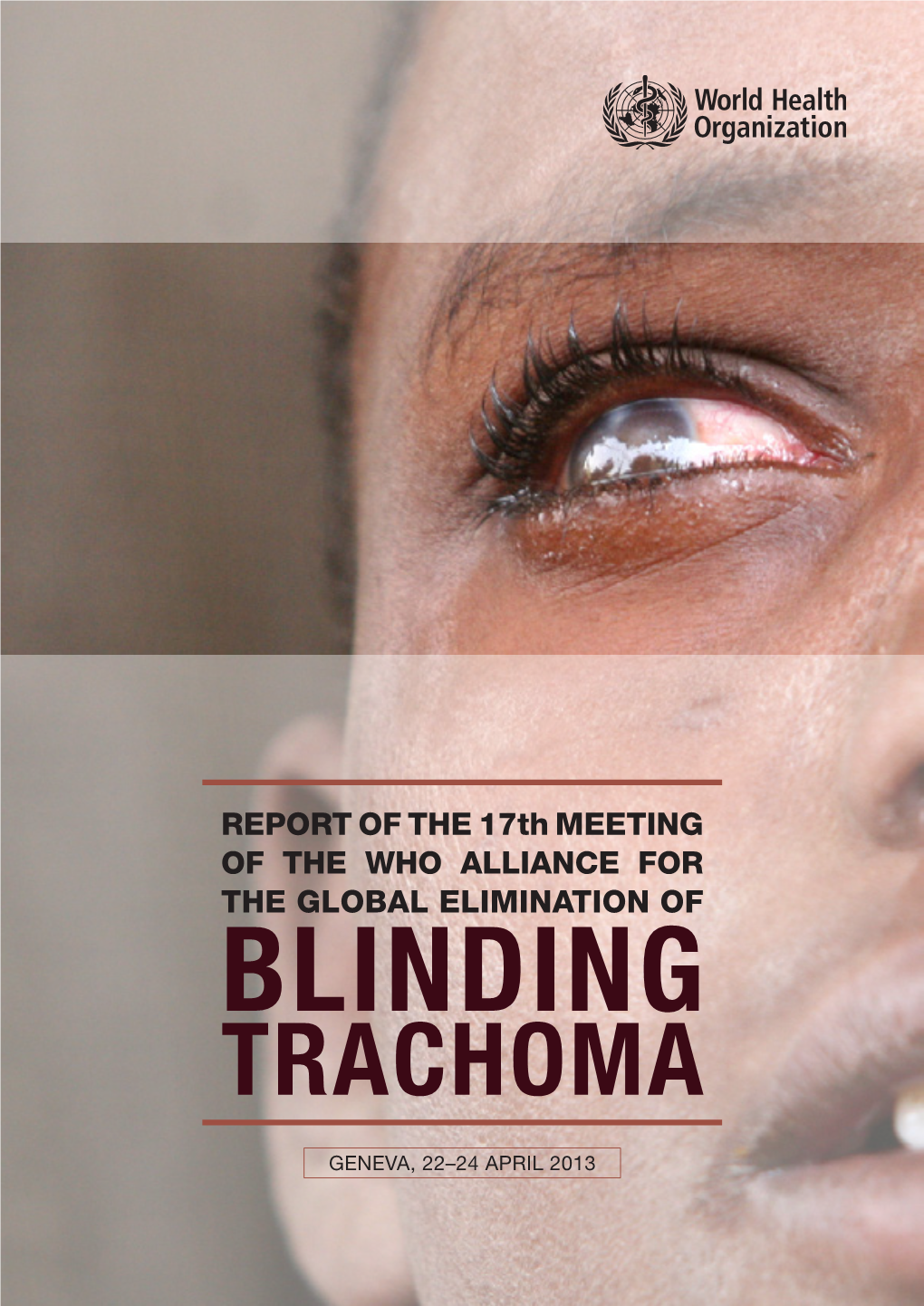 Blinding Trachoma